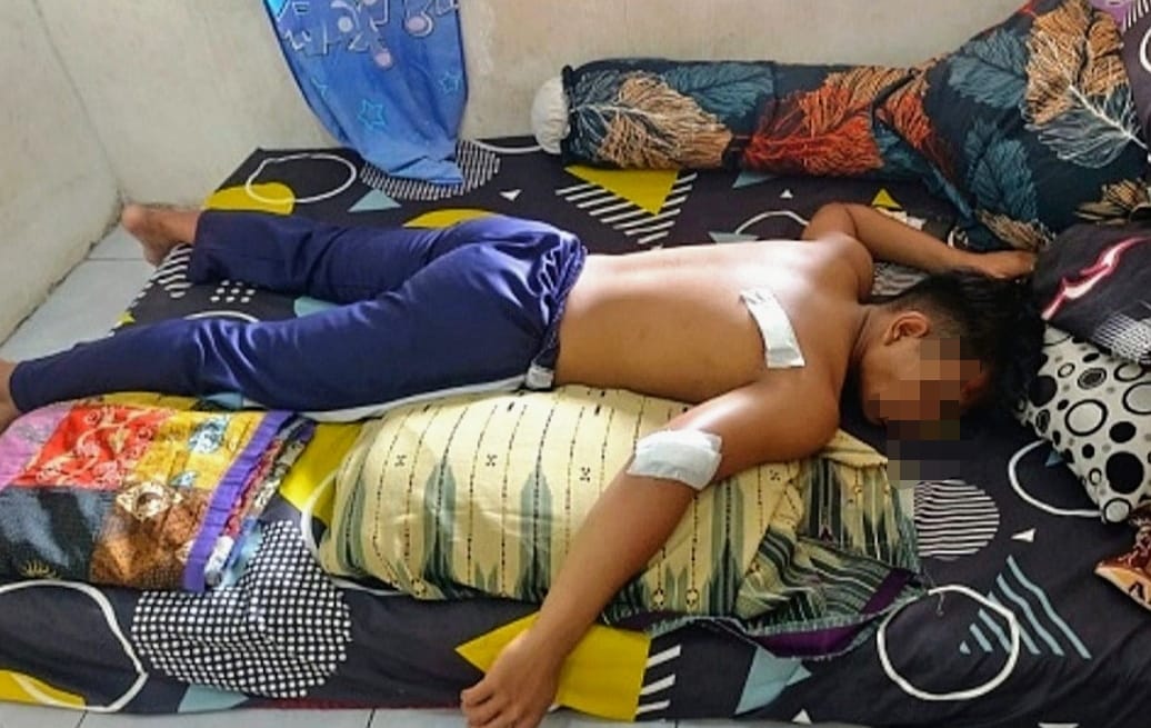 Diduga Cemburu Mantan Pacar Direbut, Pelajar Bacok Pelajar di Situbondo 