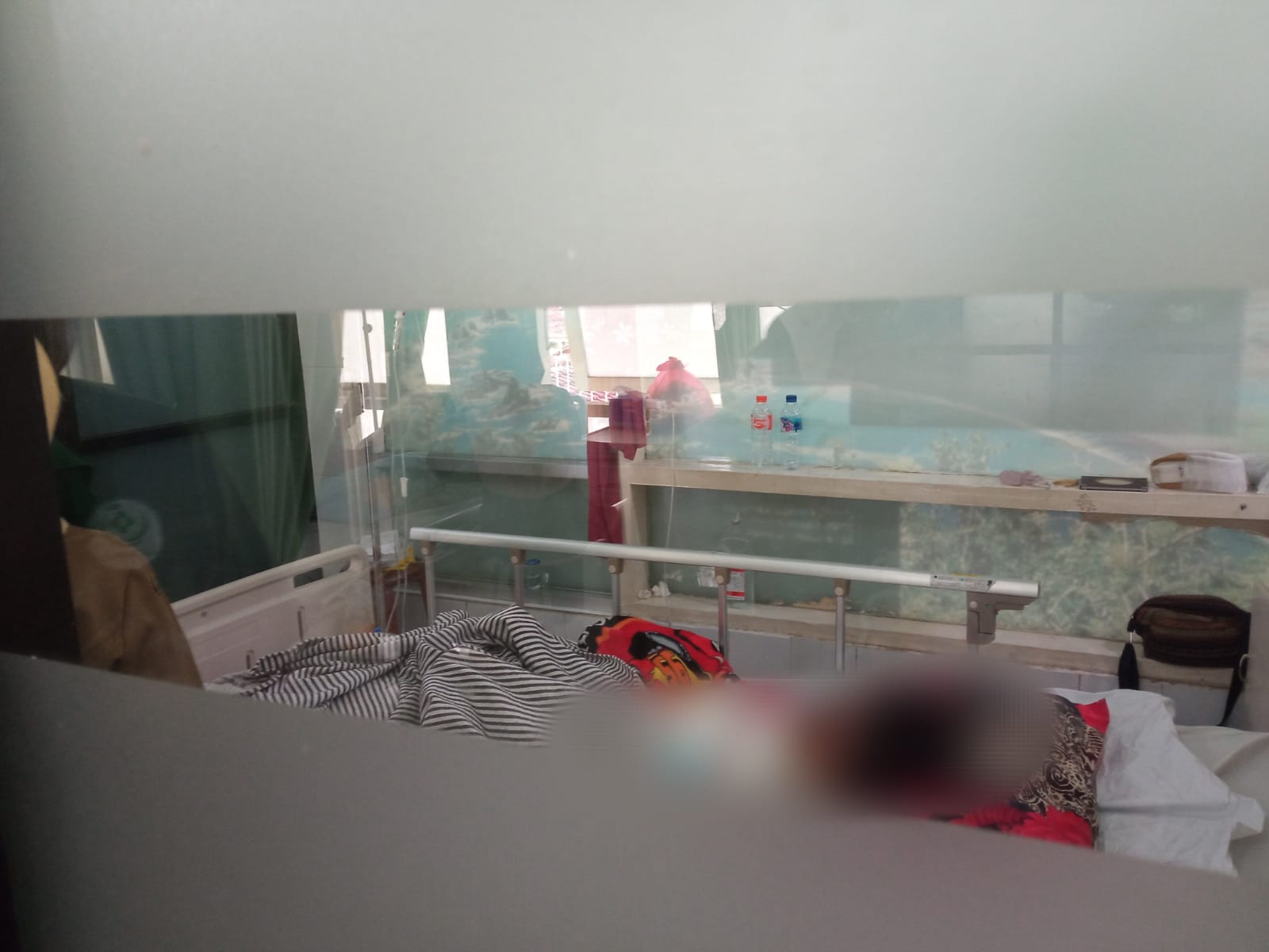 Alami Luka Bakar 45 Persen, Korban Anak Dibakar Teman Dirawat di RSD dr Soebandi