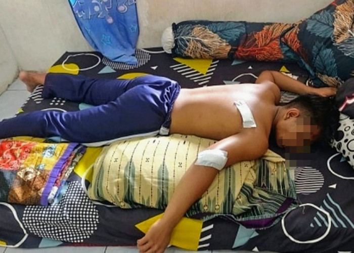 Diduga Cemburu Mantan Pacar Direbut, Pelajar Bacok Pelajar di Situbondo 