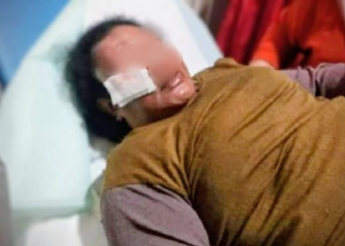 Ibuu Rumah Tangga di Situbondo Dibegal Saat Pergi Jalan Kaki ke Toko 