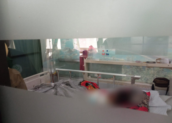 Alami Luka Bakar 45 Persen, Korban Anak Dibakar Teman Dirawat di RSD dr Soebandi